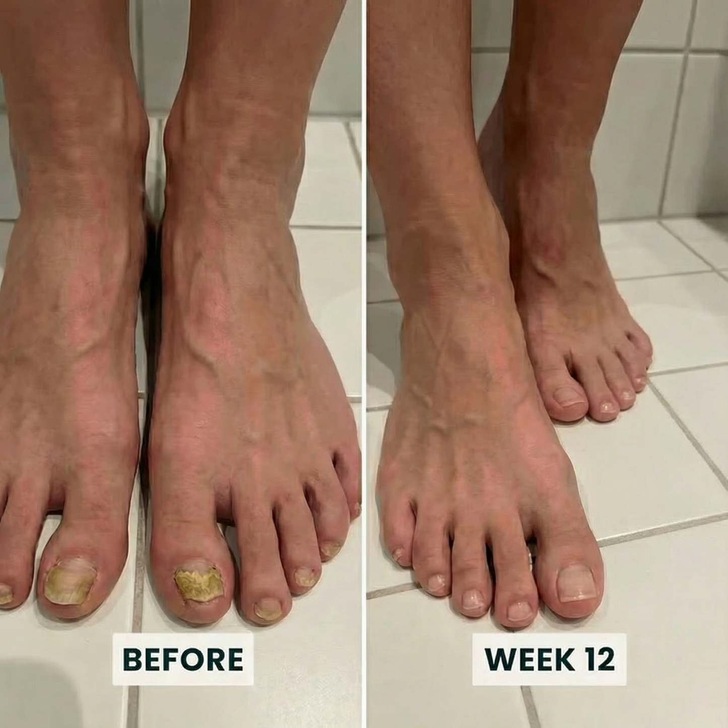 NutraMD® Clear Nail Formula