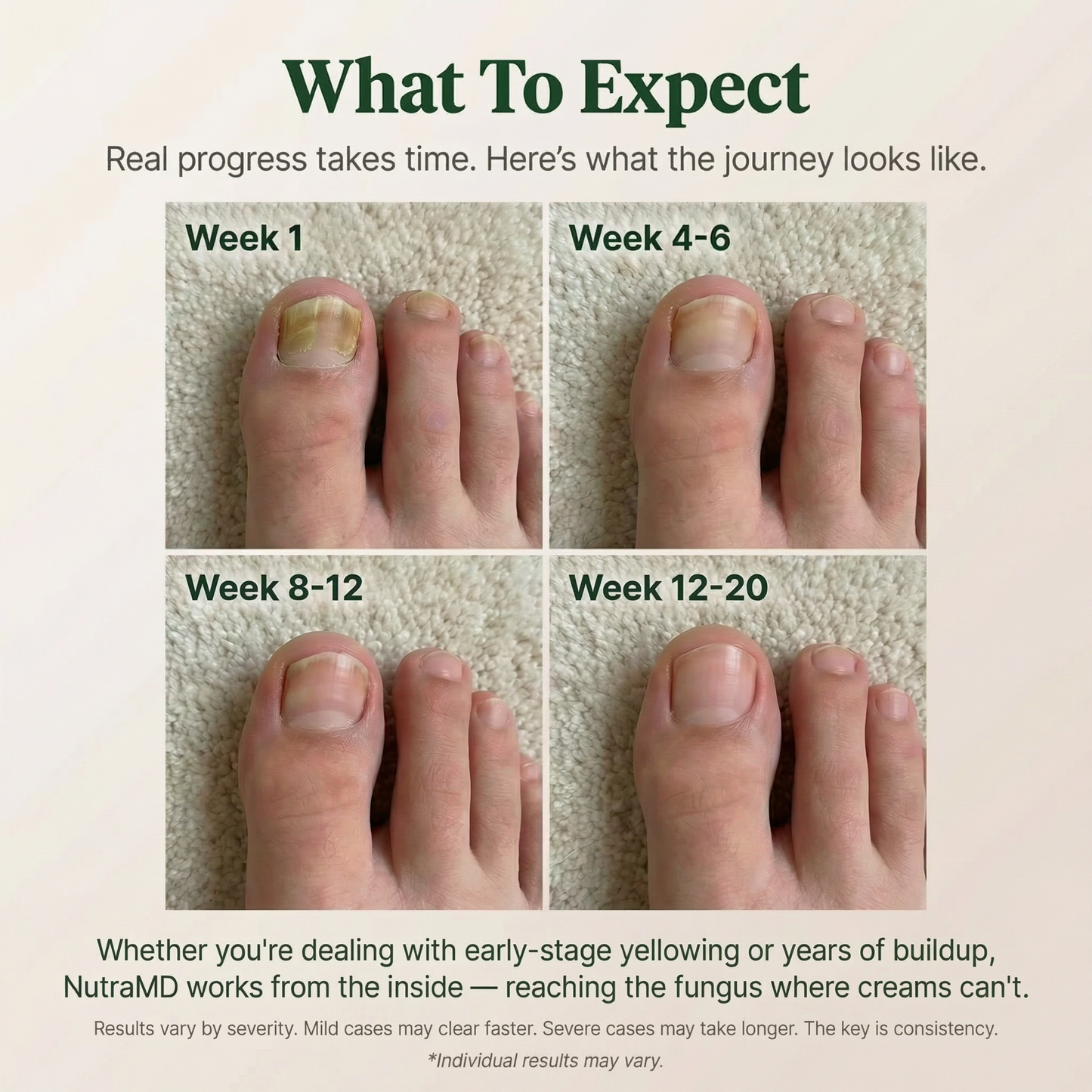 NutraMD® Clear Nail Formula